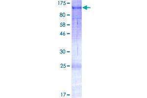 Image no. 1 for TGF-beta Activated Kinase 1/MAP3K7 Binding Protein 3 (TAB3) (AA 1-712) protein (GST tag) (ABIN1310234)