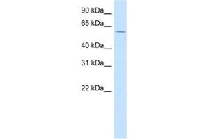 Western Blotting (WB) image for anti-Homeobox D3 (HOXD3) antibody (ABIN2461608) (HOXD3 anticorps)