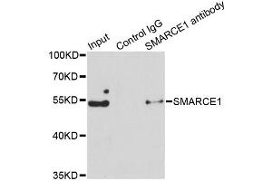 Immunoprecipitation analysis of 150ug extracts of Jurkat cells using 3ug SMARCE1 antibody (ABIN6290090). (SMARCE1 anticorps)