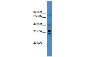GIPC3 antibody used at 0.