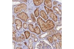 Immunohistochemical staining of human kidney with CACNA1B polyclonal antibody  shows strong cytoplasmic positivity in cells in tubules. (CACNA1B anticorps)