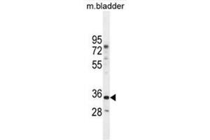C17orf59 Antibody (Center) western blot analysis in mouse bladder tissue lysates (35µg/lane). (C17orf59 anticorps  (Middle Region))
