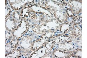 Immunohistochemical staining of paraffin-embedded Human liver tissue using anti-MTRF1L mouse monoclonal antibody. (MTRF1L anticorps)