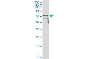 Immunoprecipitation of PIP4K2B transfected lysate using anti-PIP4K2B MaxPab rabbit polyclonal antibody and Protein A Magnetic Bead , and immunoblotted with PIP4K2B purified MaxPab mouse polyclonal antibody (B01P) .