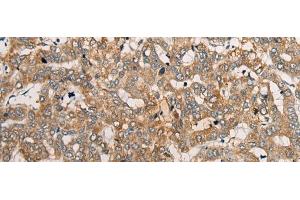 anti-Cell Cycle Exit and Neuronal Differentiation 1 (CEND1) antibody