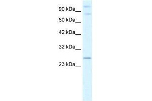 WB Suggested Anti-PCGF3 Antibody Titration:  2. (PCGF3 anticorps  (Middle Region))