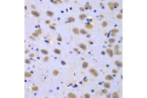 Immunohistochemistry of paraffin-embedded rat brain using CIAO1 antibody (ABIN5975509) at dilution of 1/100 (40x lens). (CIAO1 anticorps)