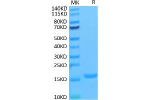 Human IL-18 on Tris-Bis PAGE under reduced condition. (IL-18 Protéine)