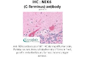 Image no. 1 for anti-NIMA (Never in Mitosis Gene A)-Related Kinase 6 (NEK6) (C-Term) antibody (ABIN1737251) (NEK6 anticorps  (C-Term))