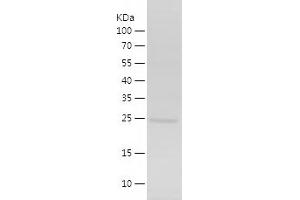 Western Blotting (WB) image for Inhibitor of Growth Family, Member 4 (ING4) (AA 1-199) protein (His tag) (ABIN7123429)