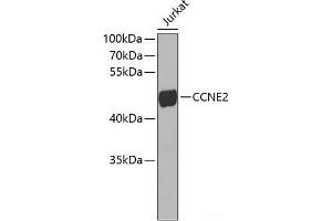 Western blot analysis of extracts of Jurkat cells using CCNE2 Polyclonal Antibody. (Cyclin E2 anticorps)