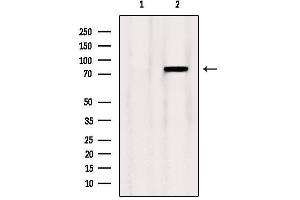 Western blot analysis of extracts from Mouse lung, using OSBP Antibody. (OSBP anticorps  (Internal Region))