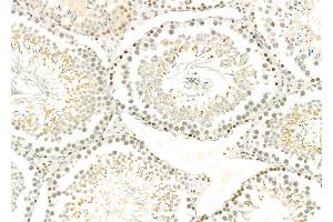 ABIN6259574 and ABIN6275790 at 1/100 staining Rat testis tissue by IHC-P. (CSRNP3 anticorps  (Internal Region))