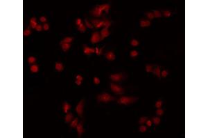 ABIN6277780 staining HeLa by IF/ICC. (PKC epsilon anticorps  (pSer729))