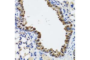 Immunohistochemistry of paraffin-embedded mouse lung using ESD antibody. (Esterase D anticorps  (AA 1-282))