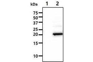 The Cell lysates (10ug) were resolved by SDS-PAGE, transferred to PVDF membrane and probed with anti-human IMP3 antibody (1:1000). (IMP3 anticorps)