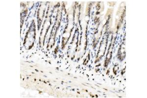 IHC analysis of HP1 alpha/CBX5 using anti-HP1 alpha/CBX5 antibody (ABIN7599058). (CBX5 anticorps  (AA 1-191))