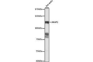 Western blot analysis of extracts of rat testis, using  antibody (ABIN7265352) at 1:1000 dilution. (AKAP3 anticorps  (AA 1-300))