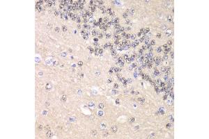 Immunohistochemistry of paraffin-embedded rat brain using CCNC antibody at dilution of 1:100 (x40 lens). (Cyclin C anticorps)