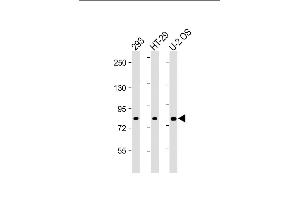 All lanes : Anti-ADD1 Antibody (Center) at 1:2000 dilution Lane 1: 293 whole cell lysate Lane 2: HT-29 whole cell lysate Lane 3: U-2 OS whole cell lysate Lysates/proteins at 20 μg per lane.