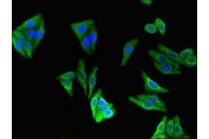 Immunofluorescent analysis of HepG2 cells using ABIN7147455 at dilution of 1:100 and Alexa Fluor 488-congugated AffiniPure Goat Anti-Rabbit IgG(H+L)