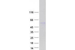 Validation with Western Blot