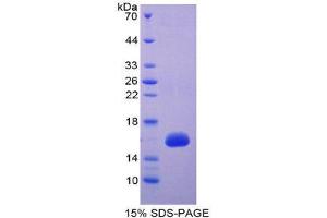 SDS-PAGE (SDS) image for High Temperature Requirement Factor A1 (AA 304-442) protein (His tag) (ABIN1981233)