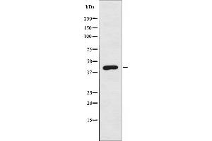 Western blot analysis of extracts from Jurkat cells, using BLZF1 antibody. (BLZF1 anticorps  (N-Term))