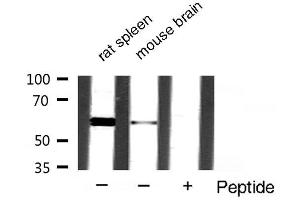 Western blot analysis of extracts of various samples,using akt2 antibody.
