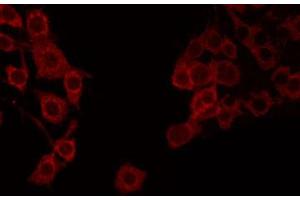 ABIN6272243 staining COLO205 by IF/ICC. (APOOL anticorps  (C-Term))