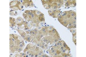 Immunohistochemistry of paraffin-embedded Human stomach using NMU Polyclonal Antibody at dilution of 1:100 (40x lens).