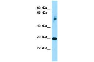Host:  Rabbit  Target Name:  Prrx1  Sample Type:  Rat Pancreas lysates  Antibody Dilution:  1. (PRRX1 anticorps  (C-Term))