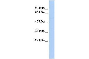 Human COLO205; WB Suggested Anti-ZNF669 Antibody Titration: 0. (ZNF669 anticorps  (N-Term))