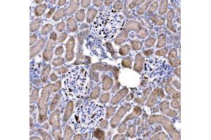 IHC analysis of p57 Kip2/CDKN1C using anti-p57 Kip2/CDKN1C antibody (ABIN7603232). (CDKN1C anticorps  (N-Term))