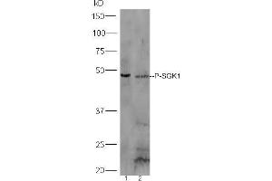 Lane 1:A431 lysates Lane 2: Mouse stomach probed with Rabbit Anti-SGK1 (Ser78) Polyclonal Antibody, Unconjugated  at 1:5000 for 90 min at 37˚C.