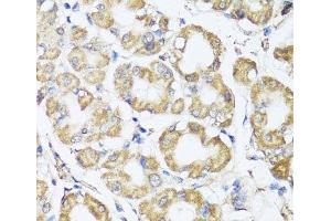 Immunohistochemistry of paraffin-embedded Human stomach using B9D1 Polyclonal Antibody at dilution of 1:100 (40x lens).