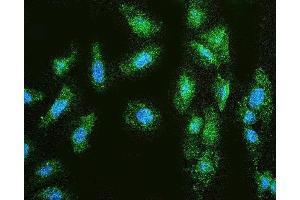 IF analysis of MMP1 using anti-MMP1 antibody (ABIN7599873).