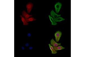 Phospho-p53 (Ser33) Antibody staining Hela cells(heat shock treatment) by IF/ICC. (p53 anticorps  (pSer33))