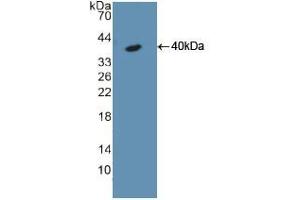 Western blot analysis of recombinant Rat KRT18. (Cytokeratin 18 anticorps  (AA 72-380))