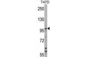 Western Blotting (WB) image for anti-Ubiquitin Protein Ligase E3A (ube3a) antibody (ABIN3001484)