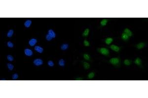 IF analysis of ARL6IP6 using anti-ARL6IP6 antibody (ABIN7603020).