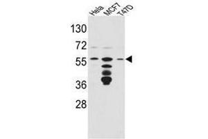 Image no. 1 for anti-FK506 Binding Protein 4, 59kDa (FKBP4) (Middle Region) antibody (ABIN453015) (FKBP4 anticorps  (Middle Region))