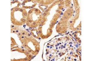 Immunohistochemical analysis of paraffin-embedded rat kidney section using VEGFR3 antibody at 1:25 dilution.