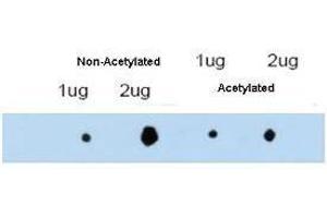 affinity purified anti-ATDC antibody shows reactivity by dot blot with acetylated and non-acetylated forms of the immunizing peptide. (TRIM29 anticorps  (Internal Region))