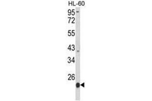 Western blot analysis of PSMB9 Antibody (C-term) in HL-60 cell line lysates (35ug/lane). (PSMB9 anticorps  (C-Term))