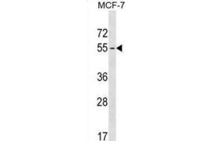 Western Blotting (WB) image for anti-Melanoma Antigen Family B, 18 (MAGEB18) antibody (ABIN3000090) (MAGEB18 anticorps)