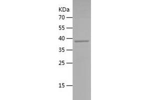 Western Blotting (WB) image for Cytochrome P450, Family 2, Subfamily C, Polypeptide 8 (CYP2C8) (AA 115-282) protein (His-IF2DI Tag) (ABIN7122581)