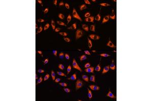 Immunofluorescence analysis of L929 cells using GNB2 Rabbit pAb  at dilution of 1:100 (40x lens).