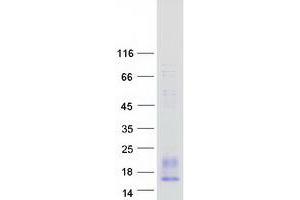 Validation with Western Blot