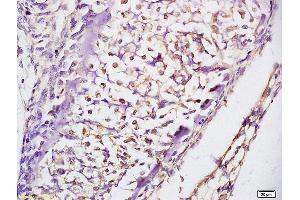 Formalin-fixed and paraffin embedded rat lung labeled with Anti Prkg1/cGKI Polyclonal Antibody, Unconjugated (ABIN720221) at 1:200 followed by conjugation to the secondary antibody and DAB staining